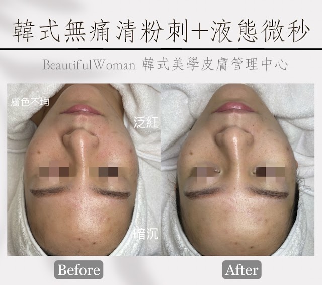 HB_蒔肌Beautiful Woman韓式美學|宜蘭羅東皮膚管理｜美甲｜美體｜水飛梭無痛清粉刺